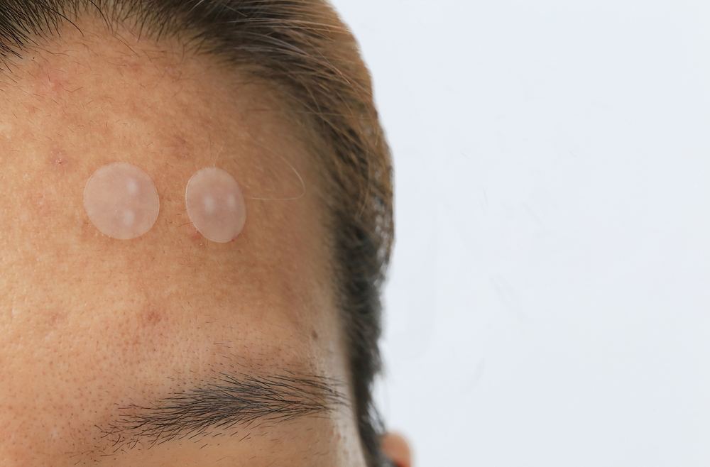 Understanding the White Stuff on Pimple Patches: A Comprehensive