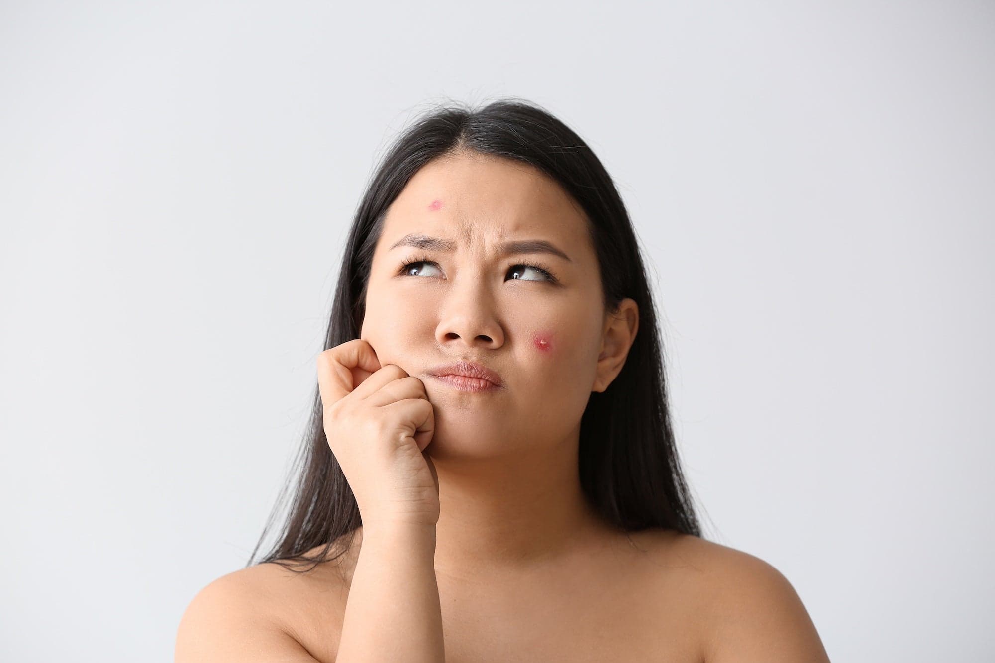 Why Your Pimple Patch Isn’t Working (and How to Fix It)